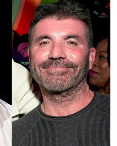 Simon Cowell admits to going overboard with his face fillers! Why did he stop using them?