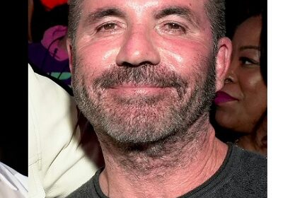 Simon Cowell admits to going overboard with his face fillers! Why did he stop using them?